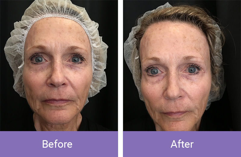 before-after3 before-after3