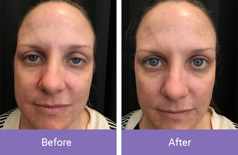 before-after4 before-after4