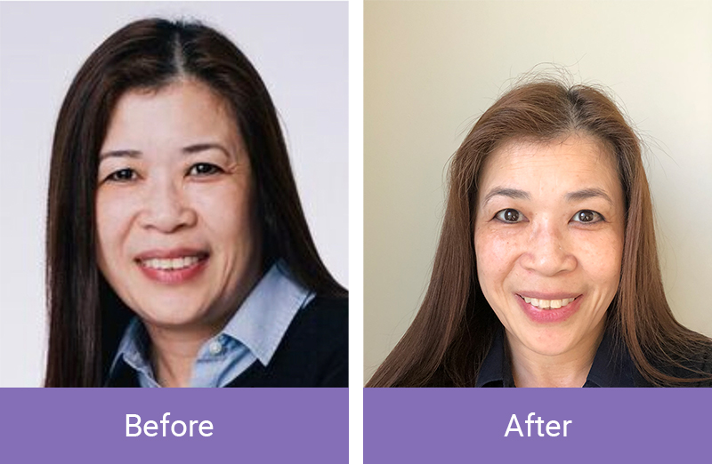 before-after5 before-after5