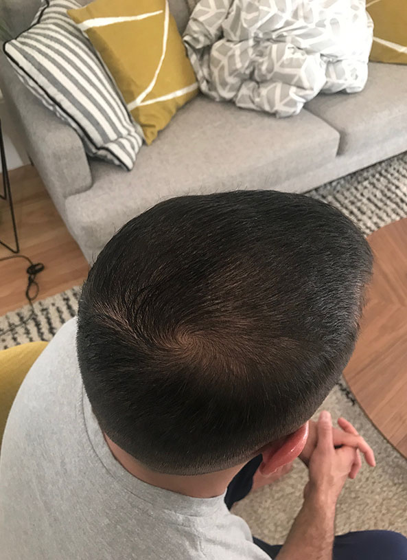 after after