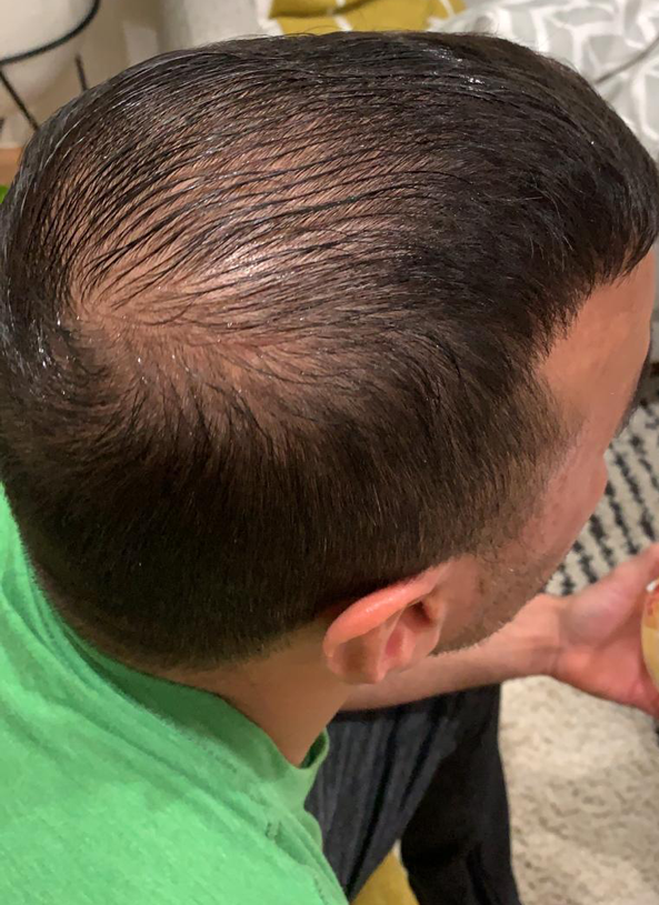 hair1 hair1