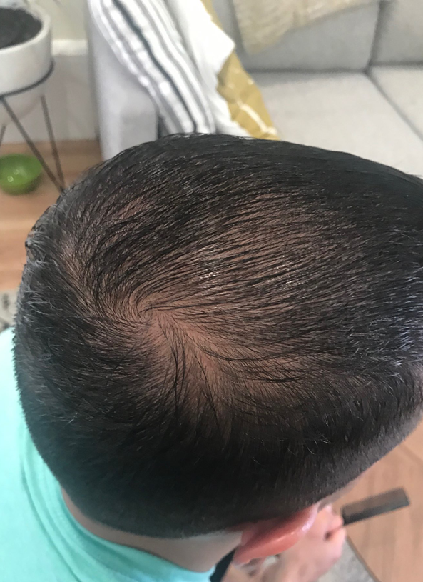 hair2 hair2